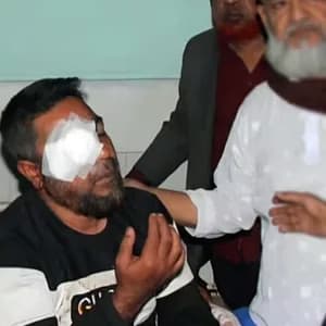 জামায়াত সমর্থকদের হামলায় বিএনপি নেতার চোখে জখম, দৃষ্টি হারানোর খবর শুনে মায়ের মৃত্যু
